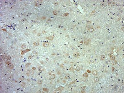 GSTA1谷胱甘肽S转移酶α1抗体