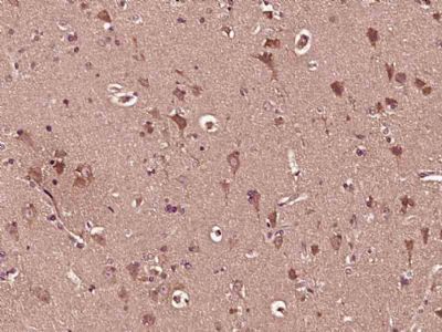 GBA β-葡萄糖脑苷脂酶抗体