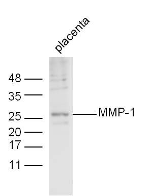 MMP1 antibody