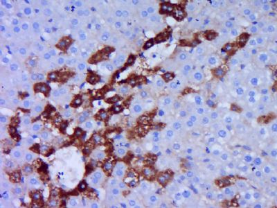 phospho-MARK2(Thr596)磷酸化丝氨酸/苏氨