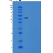 人白细胞单免疫球蛋白样受体1/LMIR1/CD300a重组蛋白C-Fc-6His