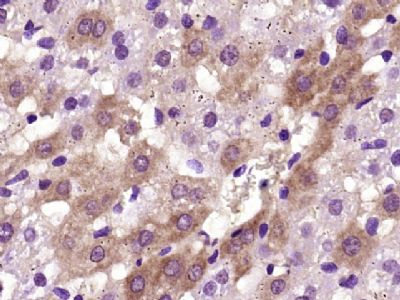 Integrin beta 1整合素β1/Integrin 