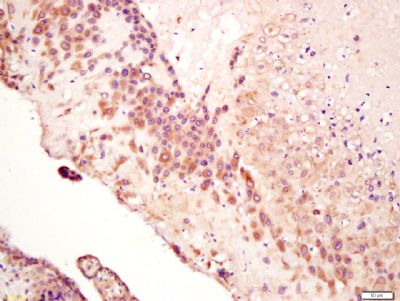 Calreticulin钙网蛋白抗体