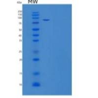 人钙粘蛋白-6/钾钙粘蛋白/CDH6重组蛋白C-Fc