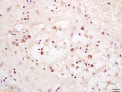 Phospho-P38 MAPK (Thr180 + Tyr