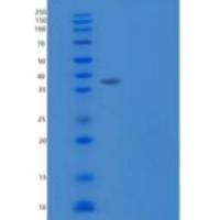 人ST6唾液酸转移酶2/ST6GalNAc2重组蛋白C-6His