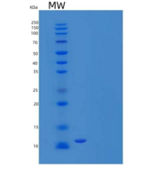 小鼠S100钙结合蛋白B(S100B)重组蛋白重组蛋白C-6