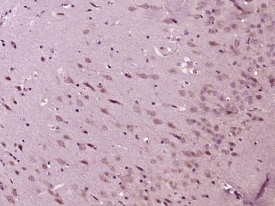 5HT3B receptor antibody