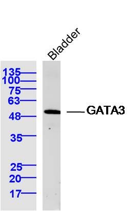 GATA3 antibody