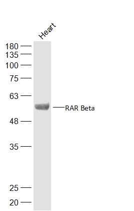 RAR Beta antibody