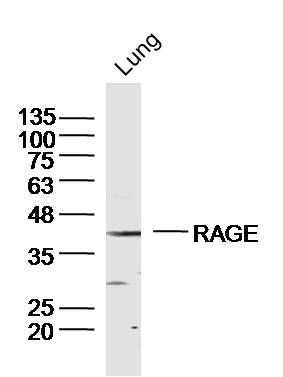 RAGE antibody