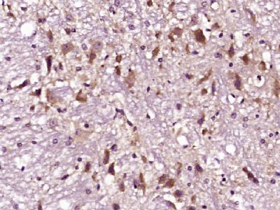 phospho-Tau (Ser356)磷酸化微管相关蛋白抗
