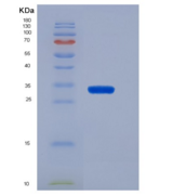 人CD19 / Leu-12重组蛋白His tag