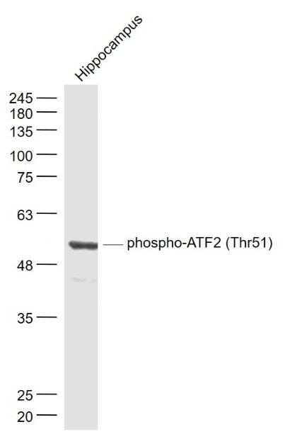 phospho-ATF2 (Thr51)磷酸化活化复制因子2