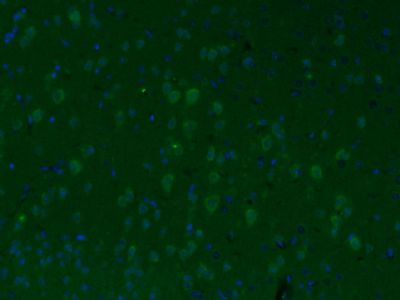 ID1 DNA结合抑制因子1抗体