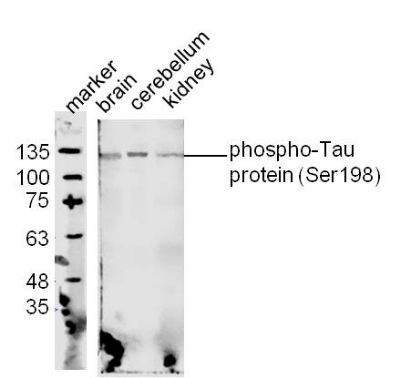 phospho-Tau protein (Ser198)磷