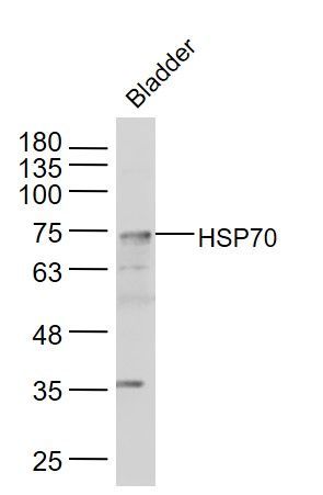 HSP70热休克蛋白-70抗体