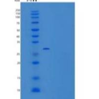 人SLAM家庭成员8/责备/SLAM F8/责备重组蛋白C-6His