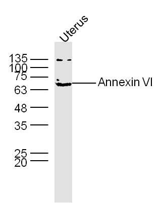 Annexin VI antibody