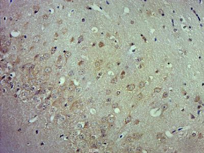 sLOX 1可溶性凝集素样氧化低密度脂蛋白受体1抗体