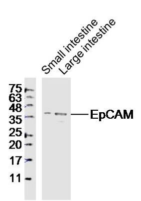 EpCAM上皮细胞粘附分子抗体