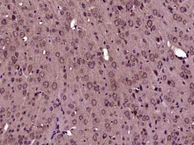 phospho-FLNC (2233)磷酸化细丝蛋白2抗体