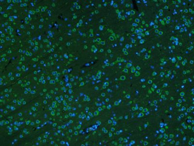 神经元核抗原抗体