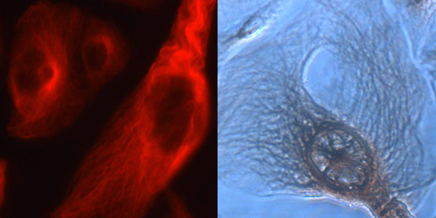 YT?免疫染色一抗稀释液