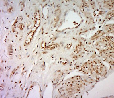 WDR61 antibody