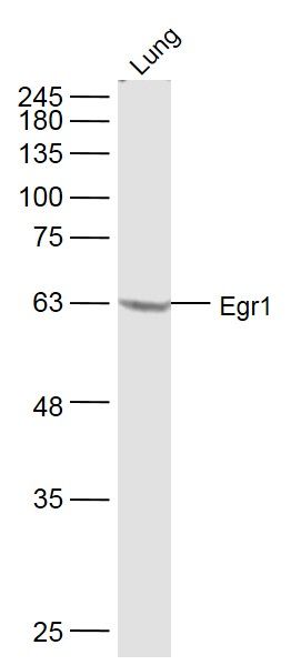 Egr1早期生长应答蛋白1靶向蛋白1抗体