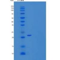 人α-1-酸性糖蛋白2/AGP2/ORM2重组蛋白C-6His