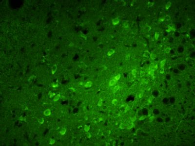 Calreticulin钙网蛋白抗体
