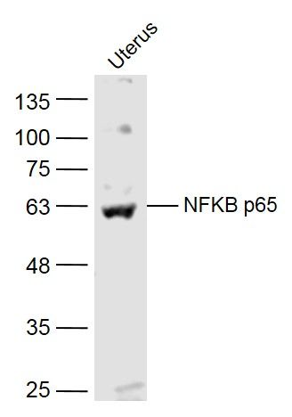 NFKB p65 antibody