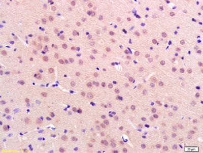 phospho-ATF2 (Thr51)磷酸化活化复制因子2