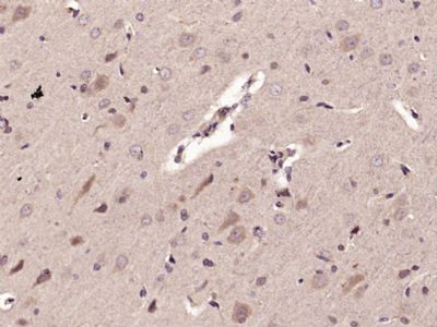 RIP3受体结合丝氨酸苏氨酸激酶3抗体