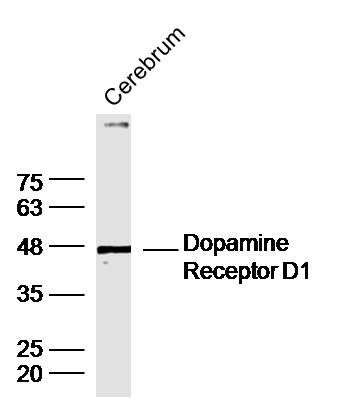 Dopamine Receptor D1多巴胺受体D1抗体