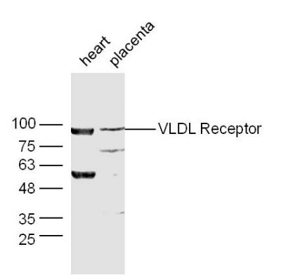 VLDL Receptor极低密度脂蛋白受体抗体