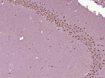 phospho-MBP(Thr232)磷酸化髓鞘碱性蛋白抗体