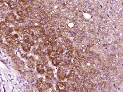 alpha 1 Antitrypsin antibody