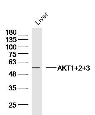 AKT1+2+3蛋白激酶AKT1,2,3抗体