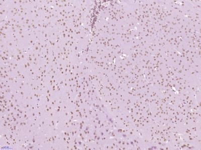 TATA binding protein TBP/TBP T