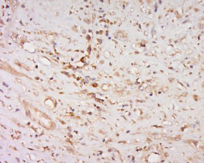 phospho-BNIP3 (Ser95)磷酸化促凋亡调节蛋