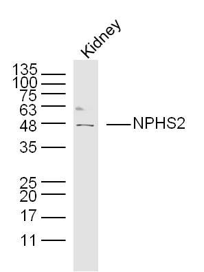 NPHS2/Podocin antibody