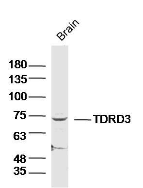 TDRD3 Tudor结构域蛋白TDRD3抗体