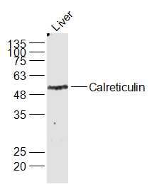 Calreticulin钙网蛋白抗体