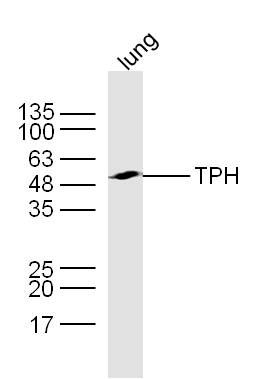 色氨酸羟化酶抗体TPH