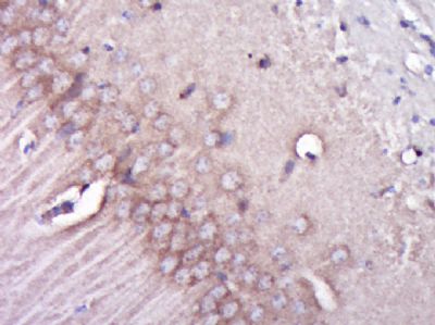 Integrin beta 1整合素β1/Integrin 