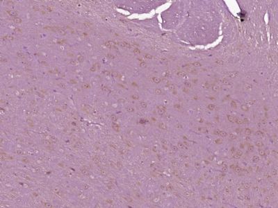 Thymosin beta 4 antibody