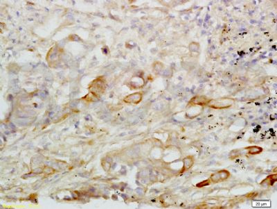 CXCL16 CXC趋化因子16抗体