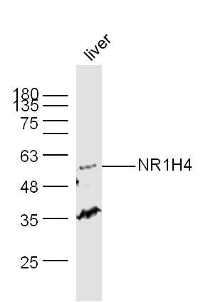 NR1H4 antibody
